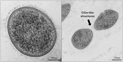 Isolation of a Methanobrevibacter gottschalkii strain from an Eastern Gray Kangaroo